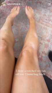 RaeLynn feet photo 20