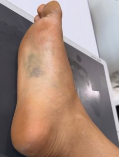 Rashmika Mandanna feet photo thumbnail