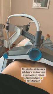 Renata Langmannova feet photo 14
