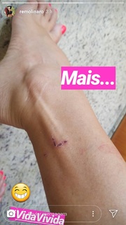 Renata Molinaro feet photo 15