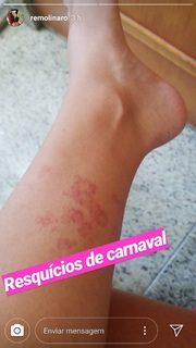 Renata Molinaro feet photo 14