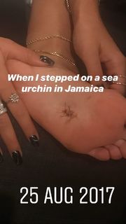 Rita Ora feet photo thumbnail