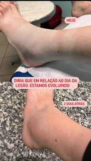 Rosamaria feet photo 5