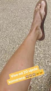 Sanja Marinkovic feet photo 13
