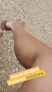 Sanja Marinkovic feet photo 11