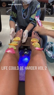 Sara Sigmunsdóttir feet photo 19