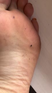 Sativa Skies feet photo thumbnail