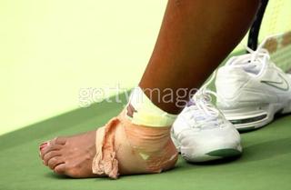 Serena Williams feet photo thumbnail