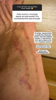 Sheilla Castro feet photo thumbnail