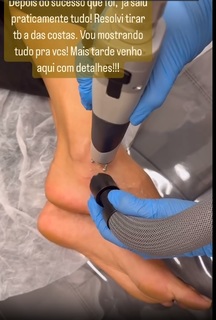 Sheilla Castro feet photo thumbnail