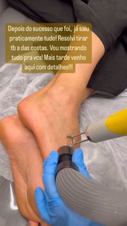 Sheilla Castro feet photo thumbnail