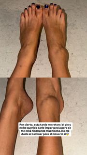 Sofía Suescun feet photo 5
