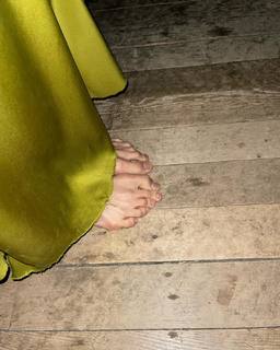 Solar feet photo 15