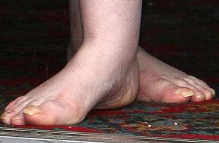 Susan Boyle feet photo 1