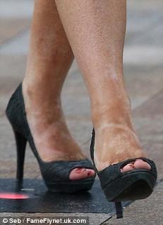 Susanna Reid feet photo thumbnail