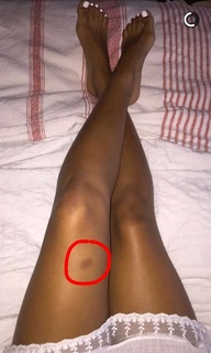 Sydney Park feet photo thumbnail