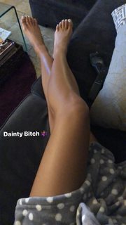 Sydney Park feet photo thumbnail
