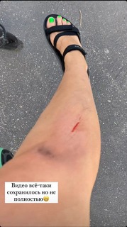 Tatyana Tkachuk feet photo 20