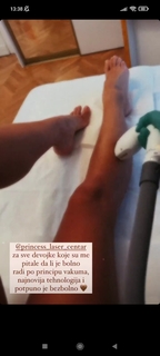 Teodora Džehverović feet photo 10