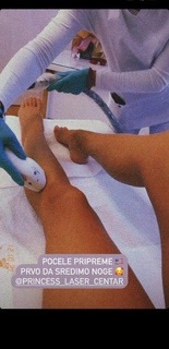 Teodora Džehverović feet photo 9