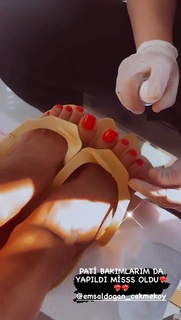 Tugce Ozbudak feet photo thumbnail