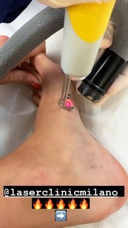 Valentina Fradegrada feet photo thumbnail