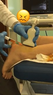 Vanessa Ferrari feet photo thumbnail