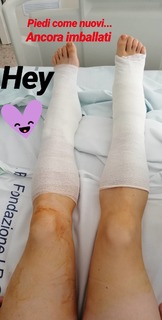 Vanessa Ferrari feet photo thumbnail