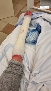 Vanessa Ferrari feet photo thumbnail