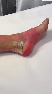 Vanessa Ferrari feet photo thumbnail