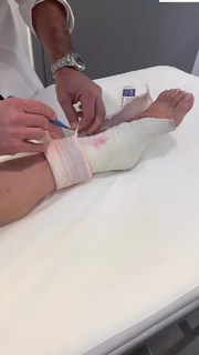 Vanessa Ferrari feet photo thumbnail