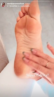 Whendy Tavares feet photo thumbnail