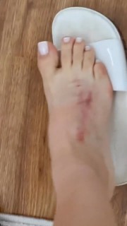 Whendy Tavares feet photo thumbnail