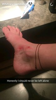 Whitney Cummings feet photo thumbnail