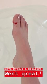Whitney Cummings feet photo thumbnail
