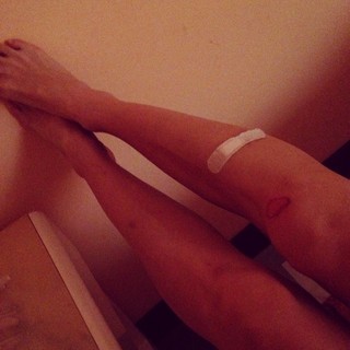 Yo-Landi Visser feet photo thumbnail