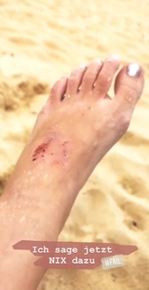 Yvonne Pferrer feet photo 9